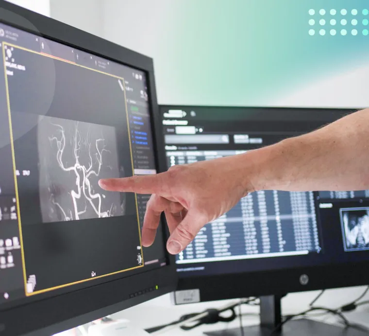 MDT&T — Pregled MR angiografije na diagnostični postaji